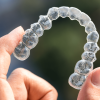 Invisalign Treatment